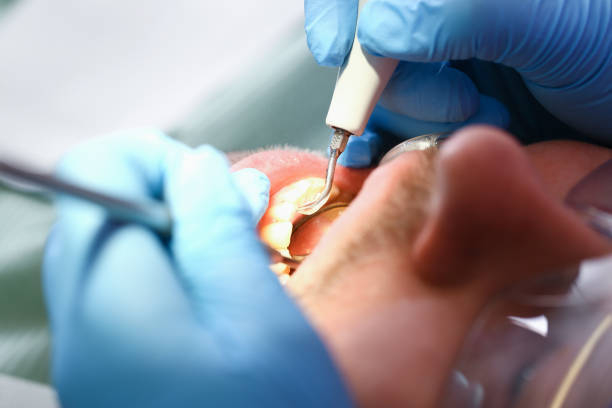 Best Urgent Care for Lost Fillings or Crowns in Highlands, NJ